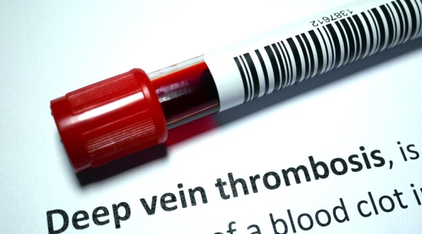 Thrombosis